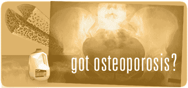 Got Osteoporosis?